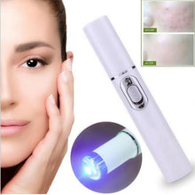 Load image into Gallery viewer, Acne and Wrinkle Laser Pen Removal - Aria Glow Up acne-wrinkle-laser-pen-removal-device, anti-aging, beauty, skincare
